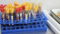На Ставрополье показатель заболеваемости ВИЧ-инфекцией за год снизился на 4,6%
